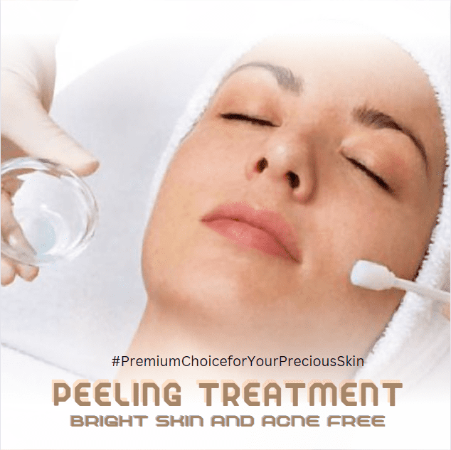 peeling-treatment
