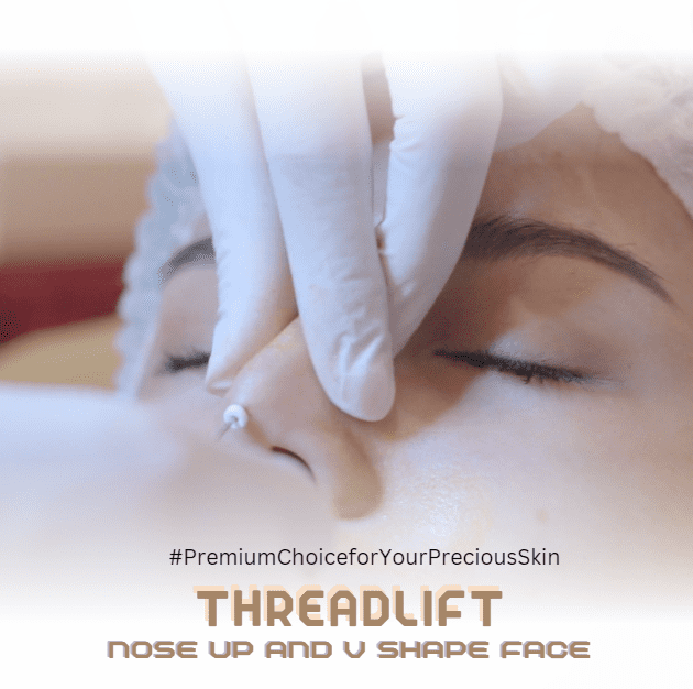 threadlift-treatment