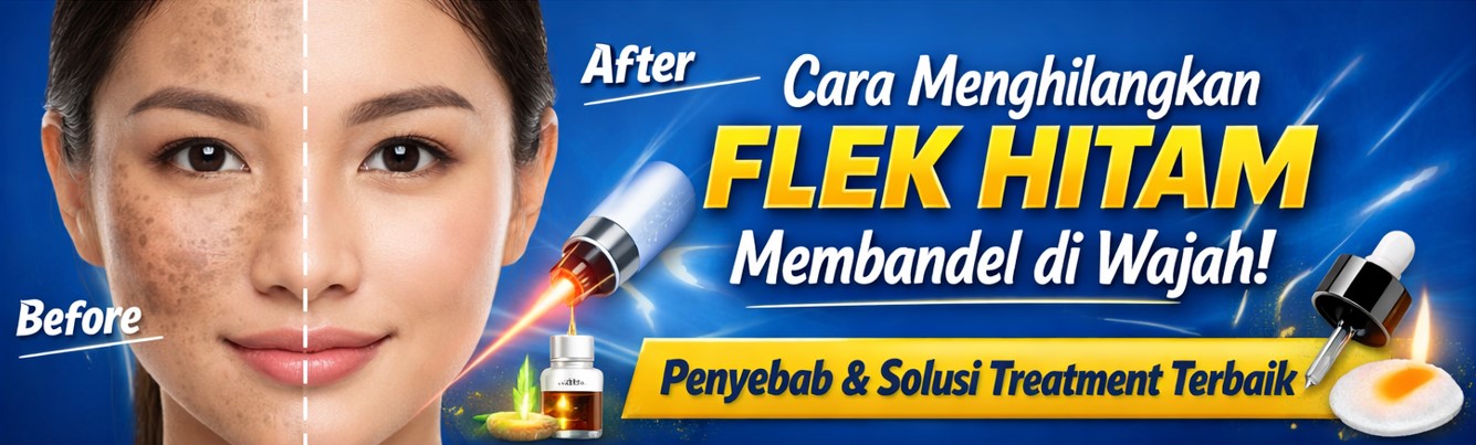 cara menghilangkan flek-hitam di klinik kecantikan